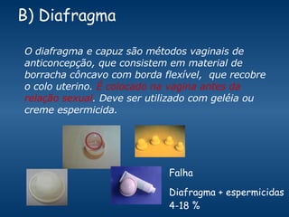 B) Diafragma  Falha Diafragma + espermicidas 4-18 % O diafragma e capuz são métodos vaginais de anticoncepção, que consistem em material de borracha côncavo com borda flexível,  que recobre o colo uterino.  É colocado na vagina antes da relação sexual . Deve ser utilizado com geléia ou creme espermicida. 