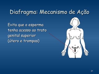 Diafragma: Mecanismo de Ação Evita que o esperma tenha acesso ao trato genital superior (útero e trompas) 