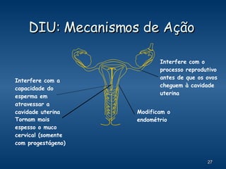 DIU: Mecanismos de Ação  Interfere com o processo reprodutivo antes de que os ovos cheguem à cavidade uterina Tornam mais espesso o muco cervical (somente com progestágeno) Interfere com a capacidade do esperma em atravessar a cavidade uterina Modificam o endométrio 