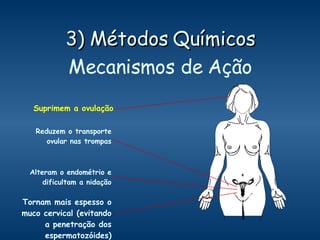 3) Métodos Químicos Mecanismos de Ação Suprimem a ovulação Alteram o endométrio e dificultam a nidação Tornam mais espesso o muco cervical (evitando a penetração dos espermatozóides) Reduzem o transporte ovular nas trompas 