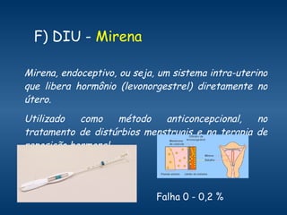 F) DIU -  Mirena   Mirena, endoceptivo, ou seja, um sistema intra-uterino que libera hormônio (levonorgestrel) diretamente no útero.  Utilizado como método anticoncepcional, no tratamento de distúrbios menstruais e na terapia de reposição hormonal.  Falha 0 - 0,2 %  