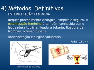 4) Métodos  Definitivos ESTERILIZAÇÃO FEMININA Requer procedimento cirúrgico, simples e seguro. A  esterilização feminina  é também conhecida como laqueadura tubária, ligadura tubária, ligadura de trompas, oclusão tubária anticoncepção cirúrgica voluntária. Falha:  0,1-0,4% Fonte : Church e Geller 1990. 