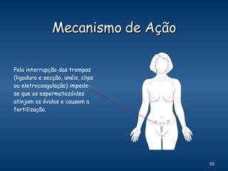 Mecanismo de Ação Pela interrupção das trompas (ligadura e secção, anéis, clips ou eletrocoagulação) impede-se que os espermatozóides atinjam os óvulos e causem a fertilização. 