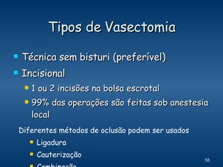 Tipos de Vasectomia Técnica sem bisturi (preferível)  Incisional 1 ou 2 incisões na bolsa escrotal 99% das operações são feitas sob anestesia local Diferentes métodos de oclusão podem ser usados Ligadura Cauterização Combinação 