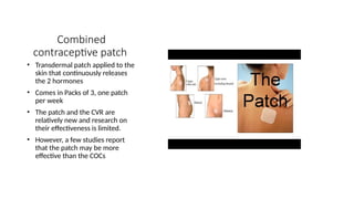 Combined
contraceptive patch
• Transdermal patch applied to the
skin that continuously releases
the 2 hormones
• Comes in Packs of 3, one patch
per week
• The patch and the CVR are
relatively new and research on
their effectiveness is limited.
• However, a few studies report
that the patch may be more
effective than the COCs
 