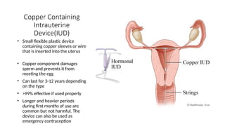 Copper Containing
Intrauterine
Device(IUD)
• Small flexible plastic device
containing copper sleeves or wire
that is inserted into the uterus
• Copper component damages
sperm and prevents it from
meeting the egg
• Can last for 3-12 years depending
on the type
• >99% effective if used properly
• Longer and heavier periods
during first months of use are
common but not harmful. The
device can also be used as
emergency contraception
 