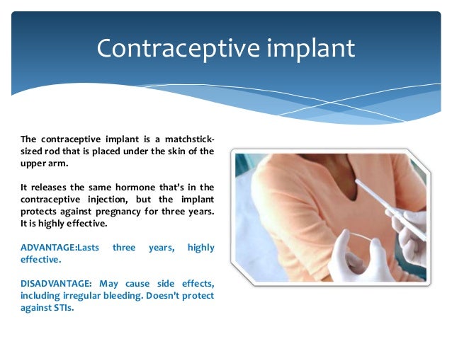 the advantages and disadvantages of emergency contraception Oral contraception september 20, the most commonly used type of birth control pill is the combined oral contraceptive may be used for emergency contraception. the advantages and disadvantages of emergency contraception Oral contraception september 20, the most commonly used type of birth control pill is the combined oral contraceptive may be used for emergency contraception.
