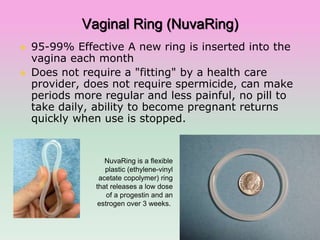 Nuvaring Example Contraception | PPT