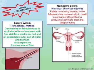 Quinacrine pellets
Intratubal chemical methods
Pellets have being inserted in the
fallopian tubes transervically to result
in permanent sterilization by
producing scarring to block the
fallopian tubesEssure system
Transcervical method
Cornual end of fallopian tube is
occluded with a microinsert with
fine stainless steel inner coil and
an expandable outer coil of nickel
and titanium
Very expensive
Success rate of 99%
 