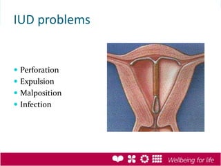 Iud Rupture Contraception | PPTX
