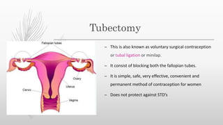 Tubesctomy Methods Contraception | PPTX