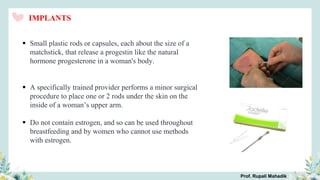 IMPLANTS
 Small plastic rods or capsules, each about the size of a
matchstick, that release a progestin like the natural
hormone progesterone in a woman's body.
 A specifically trained provider performs a minor surgical
procedure to place one or 2 rods under the skin on the
inside of a woman’s upper arm.
 Do not contain estrogen, and so can be used throughout
breastfeeding and by women who cannot use methods
with estrogen.
Prof. Rupali Mahadik
 