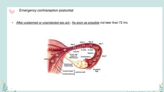 Emergency contraception postcoital
• After unplanned or unprotected sex act - As soon as possible not later than 72 hrs
 