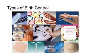 Types of Birth Control
 
