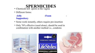 SPERMICIDES
• Chemicals kill sperm in the vagina
• Different forms:
-Jelly -Foam -
Suppository
• Some work instantly, others require pre-insertion
• Only 76% effective (used alone), should be used in
combination with another method i.e., condoms
 