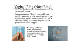 Vaginal Ring (NuvaRing)
• 95-99% Effective A new ring is inserted into the
vagina each month
• Does not require a "fitting" by a health care
provider, does not require spermicide, can make
periods more regular and less painful, no pill to
take daily, ability to become pregnant returns
quickly when use is stopped.
Nuva Ring is a flexible
plastic (ethylene-vinyl
acetate copolymer) ring that
releases a low dose of a
progestin and an estrogen
over 3 weeks.
 