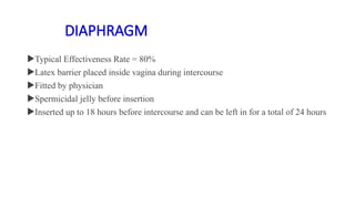 DIAPHRAGM
Typical Effectiveness Rate = 80%
Latex barrier placed inside vagina during intercourse
Fitted by physician
Spermicidal jelly before insertion
Inserted up to 18 hours before intercourse and can be left in for a total of 24 hours
 