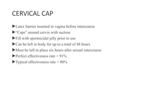 CERVICAL CAP
Latex barrier inserted in vagina before intercourse
“Caps” around cervix with suction
Fill with spermicidal jelly prior to use
Can be left in body for up to a total of 48 hours
Must be left in place six hours after sexual intercourse
Perfect effectiveness rate = 91%
Typical effectiveness rate = 80%
 