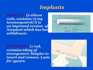 Contraception by Dr Patrick Idoko of the UTG.pdf