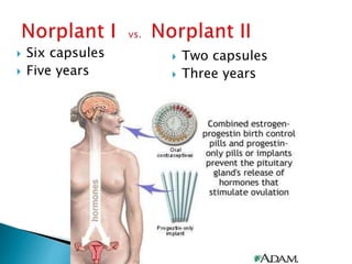  Six capsules
 Five years
 Two capsules
 Three years
 