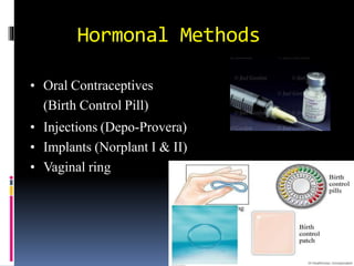 Contraception | PPTX