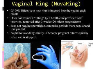 Navaring Contraception | PPTX