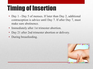 Timing of Insertion
• Day 1 - Day 5 of menses. If later than Day 2, additional
contraception is advice until Day 7. If after Day 7, must
make sure abstinence.
• Immediately after 1st trimester abortion.
• Day 21 after 2nd trimester abortion or delivery.
• During breasfeeding.
 