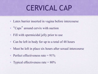 CERVICAL CAP
• Latex barrier inserted in vagina before intercourse
• “Caps” around cervix with suction
• Fill with spermicidal jelly prior to use
• Can be left in body for up to a total of 48 hours
• Must be left in place six hours after sexual intercourse
• Perfect effectiveness rate = 91%
• Typical effectiveness rate = 80%
 
