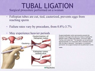 TUBAL LIGATION
• Surgical procedure performed on a woman
• Fallopian tubes are cut, tied, cauterized, prevents eggs from
reaching sperm
• Failure rates vary by procedure, from 0.8%-3.7%
• May experience heavier periods
Surgical sterilization which permanently prevents the
transport of the egg to the uterus by means of sealing the
fallopian tubes is called tubal ligation, commonly called
"having one's tubes tied." This operation can be performed
laparoscopically or in conjunction with a Cesarean section,
after the baby is delivered. Tubal ligation is considered
permanent, but surgical reversal can be performed in some
cases
 