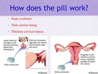 How does the pill work?
• Stops ovulation
• Thins uterine lining
• Thickens cervical mucus
 