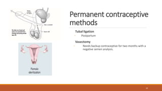 Permanent Birth Control Methods contraception methods, steroids IUDs ,natural method | PPTX