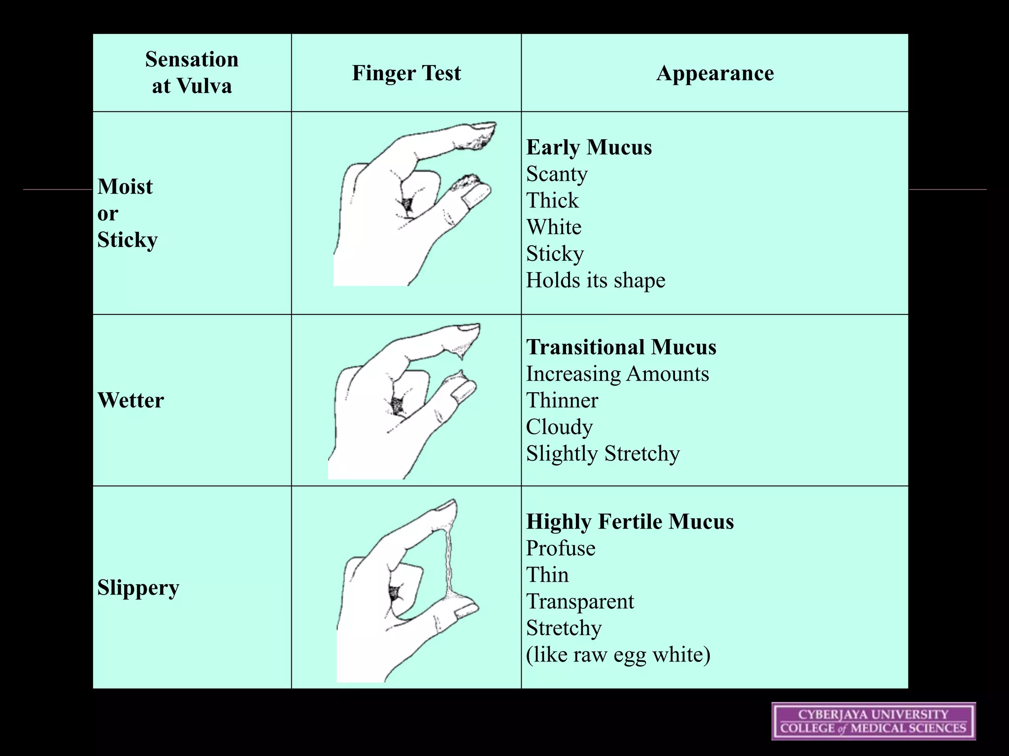 Wednesday 15 October
2003 45
Sensation 
at Vulva
Finger Test Appearance
Moist 
or 
Sticky
Early Mucus 
Scanty 
Thick 
White 
Sticky 
Holds its shape
Wetter
Transitional Mucus 
Increasing Amounts 
Thinner 
Cloudy 
Slightly Stretchy
Slippery
Highly Fertile Mucus 
Profuse 
Thin 
Transparent 
Stretchy 
(like raw egg white)
 