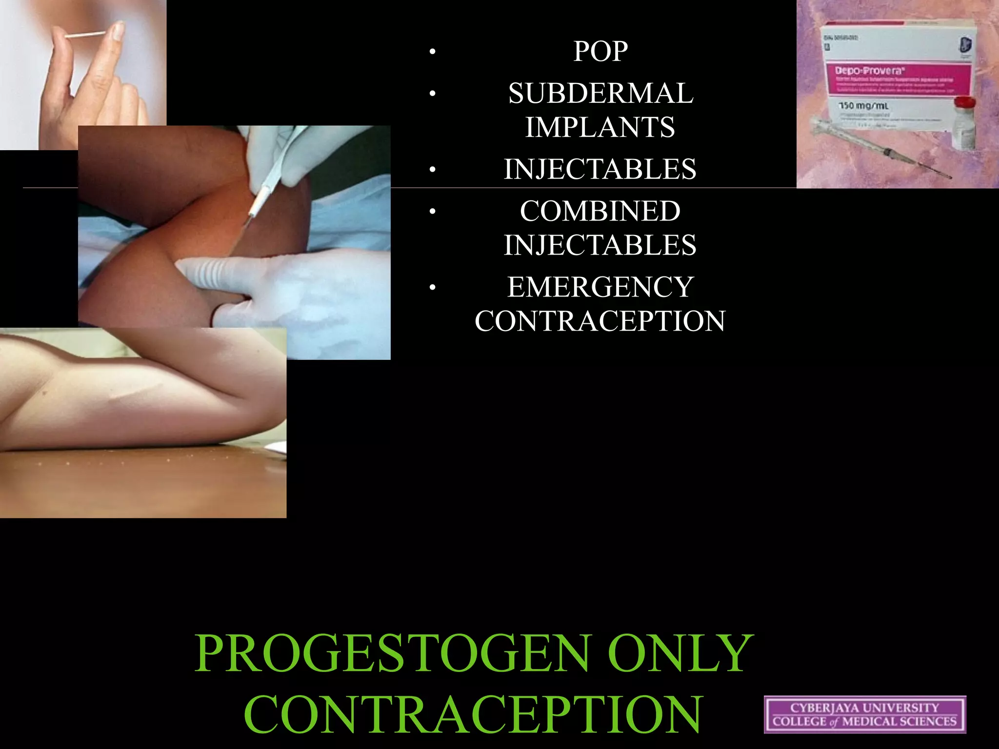 PROGESTOGEN ONLY
CONTRACEPTION
● POP
● SUBDERMAL
IMPLANTS
● INJECTABLES
● COMBINED
INJECTABLES
● EMERGENCY
CONTRACEPTION
 