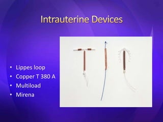 • Lippes loop
• Copper T 380 A
• Multiload
• Mirena
 