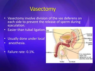 Vasectomy
• Vasectomy involve division of the vas deferens on
each side to prevent the release of sperm during
ejaculation.
• Easier than tubal ligation.
• Usually done under local
• anesthesia.
• Failure rate: 0.1%.
 