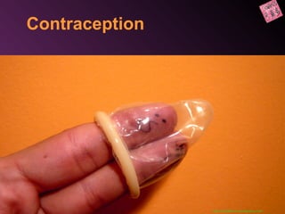 Contraception
___________________________
http://biodeluna.wordpress.com
 