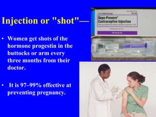 Injection or "shot"— 
• Women get shots of the 
hormone progestin in the 
buttocks or arm every 
three months from their 
doctor. 
• It is 97–99% effective at 
preventing pregnancy. 
 