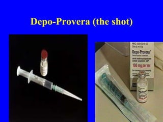 Depo-Provera (the shot) 
 