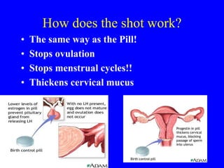 How does the shot work? 
• The same way as the Pill! 
• Stops ovulation 
• Stops menstrual cycles!! 
• Thickens cervical mucus 
 