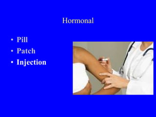 Hormonal 
• Pill 
• Patch 
• Injection 
 
