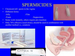 SPERMICIDES 
• Chemicals kill sperm in the vagina 
• Different forms: 
-Jelly -Film 
-Foam -Suppository 
• Some work instantly, others require pre-insertion 
• Only 76% effective (used alone), should be used in combination with 
another method i.e., condoms 
 
