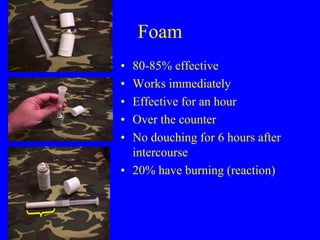 Foam 
• 80-85% effective 
• Works immediately 
• Effective for an hour 
• Over the counter 
• No douching for 6 hours after 
intercourse 
• 20% have burning (reaction) 
 