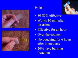 Film 
• 80-85% effective 
• Works 10 min after 
insertion 
• Effective for an hour 
• Over the counter 
• No douching for 6 hours 
after intercourse 
• 20% have burning 
(reaction) 
 