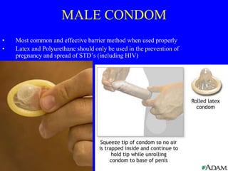 MALE CONDOM 
• Most common and effective barrier method when used properly 
• Latex and Polyurethane should only be used in the prevention of 
pregnancy and spread of STD’s (including HIV) 
 