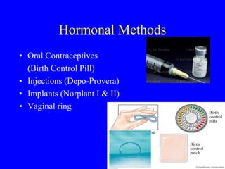 Hormonal Methods 
• Oral Contraceptives 
(Birth Control Pill) 
• Injections (Depo-Provera) 
• Implants (Norplant I & II) 
• Vaginal ring 
 