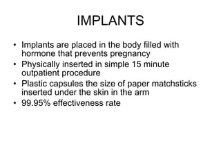 IMPLANTS Implants are placed in the body filled with hormone that prevents pregnancy Physically inserted in simple 15 minute outpatient procedure Plastic capsules the size of paper matchsticks inserted under the skin in the arm 99.95% effectiveness rate 