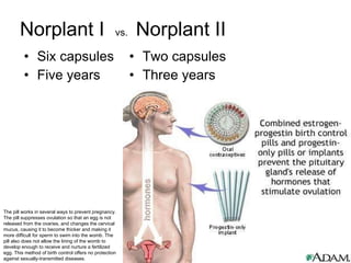 Norplant I  vs.  Norplant II Six capsules Five years Two capsules Three years The pill works in several ways to prevent pregnancy. The pill suppresses ovulation so that an egg is not released from the ovaries, and changes the cervical mucus, causing it to become thicker and making it more difficult for sperm to swim into the womb. The pill also does not allow the lining of the womb to develop enough to receive and nurture a fertilized egg. This method of birth control offers no protection against sexually-transmitted diseases. 