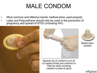 MALE CONDOM Most common and effective barrier method when used properly Latex and Polyurethane should only be used in the prevention of pregnancy and spread of STD’s (including HIV) 