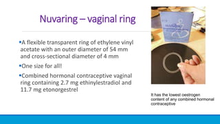 Nuvaring Example Contraception where have we been and where are we going.pptx