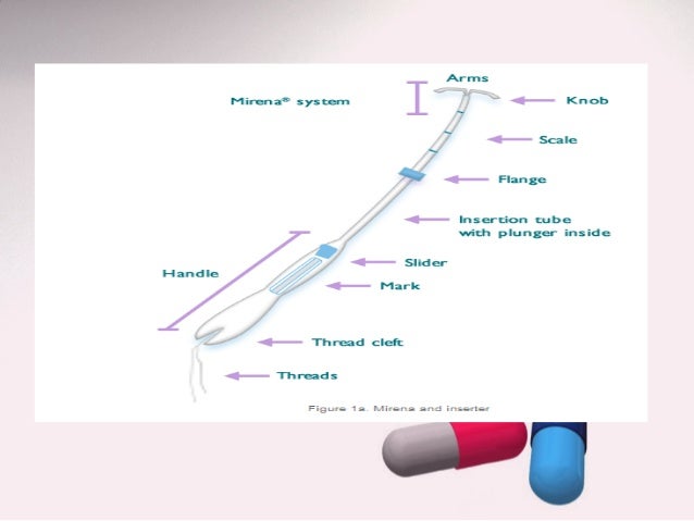 Controlled drug delivery elution mirena ius